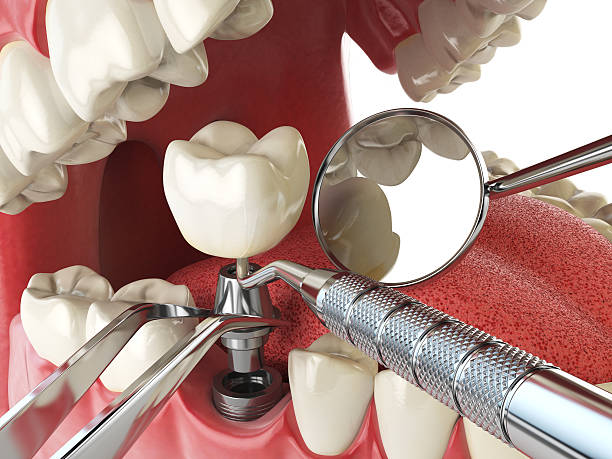 Best Urgent Tooth Repair  in Pine Mountain, GA